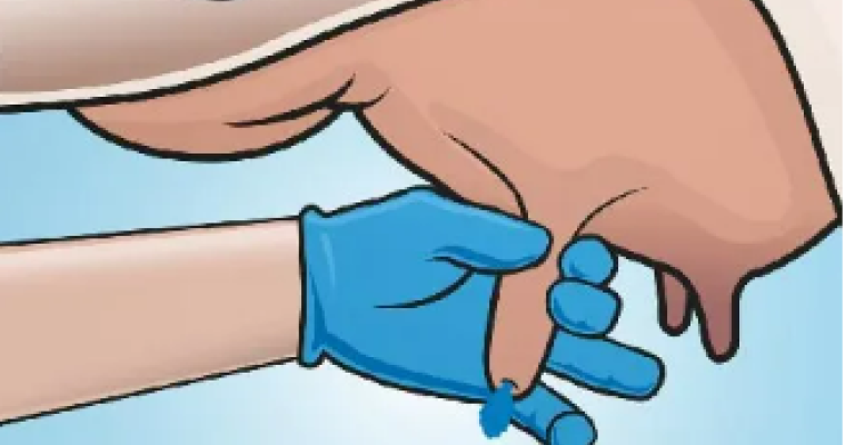 comment retirer Ubroseal blue